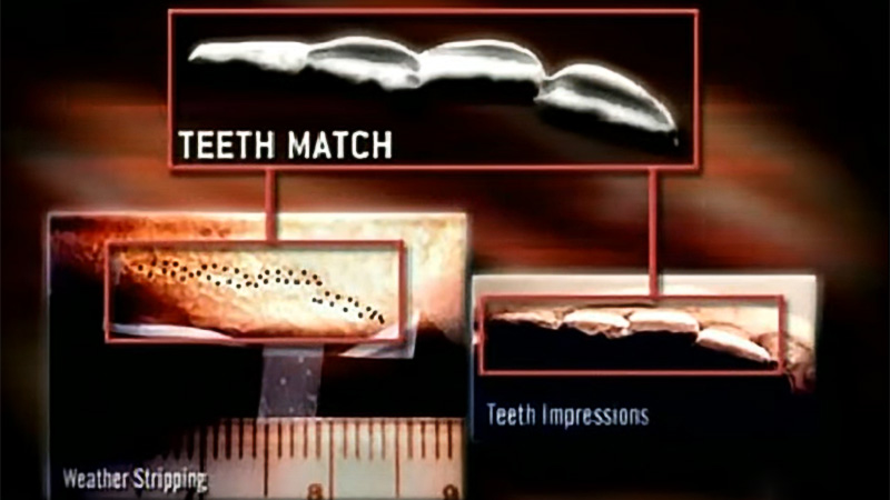 Dental impression comparison