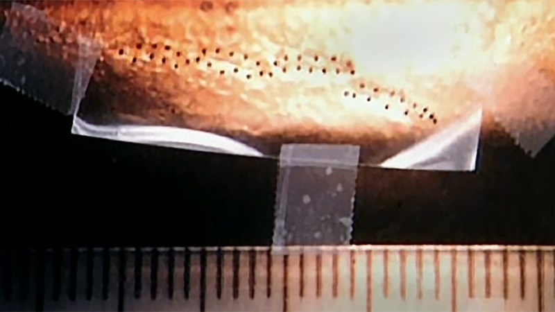 Details of bite mark impression